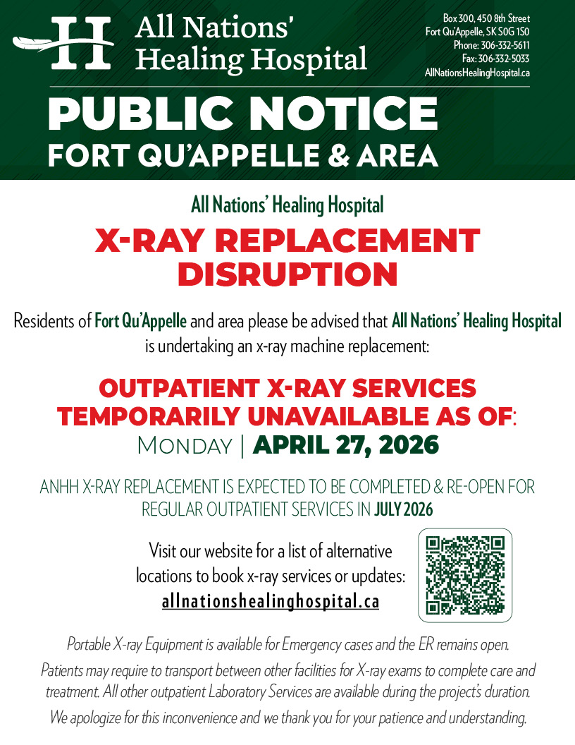 2026Apr20-Xray-Replacement.jpg
